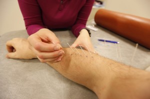 Muskelbehandling med nåler har fram til nå vært mulig å få i Flatanger. Siden Guro Vilvang slutter, blir det også slutt på denne behandlingsformen.