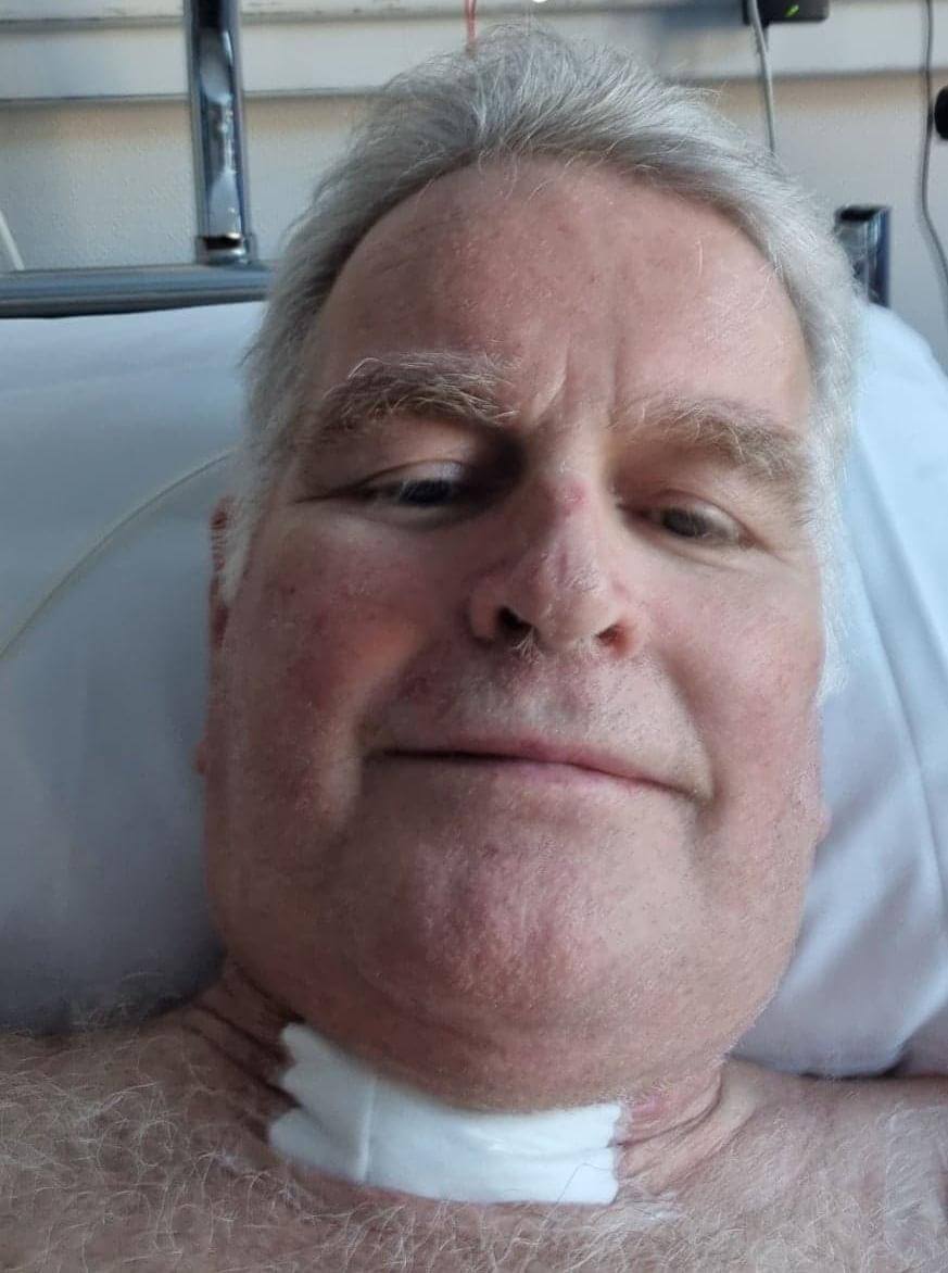 Arne Skorstad tok dette selvportrettet 1. april. da han hadde f&aring;tt fjernet sonden i nesen og dusjet for f&oslash;rst gang siden ulykken. Bildet sendte han p&aring; Snap til gjengen som dro til Bod&oslash; for &aring; se Bod&oslash;/Glimt mot Rosenborg - en tur han selv skulle v&aelig;rt med p&aring;. 